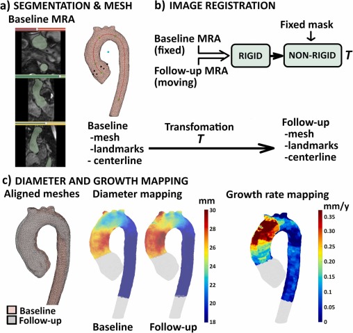 Dux-Santoy JCMR 2024