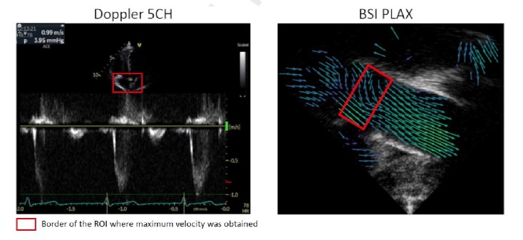 Freixas-Benavente Int J Cardiol 2026