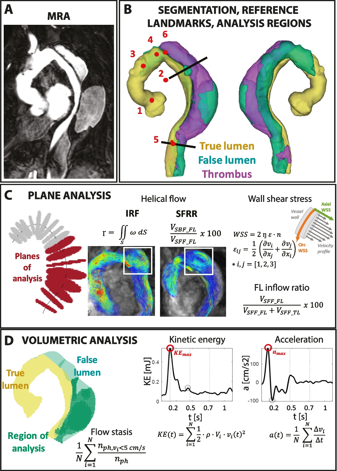 Ruiz-Munoz European Radiology 2024