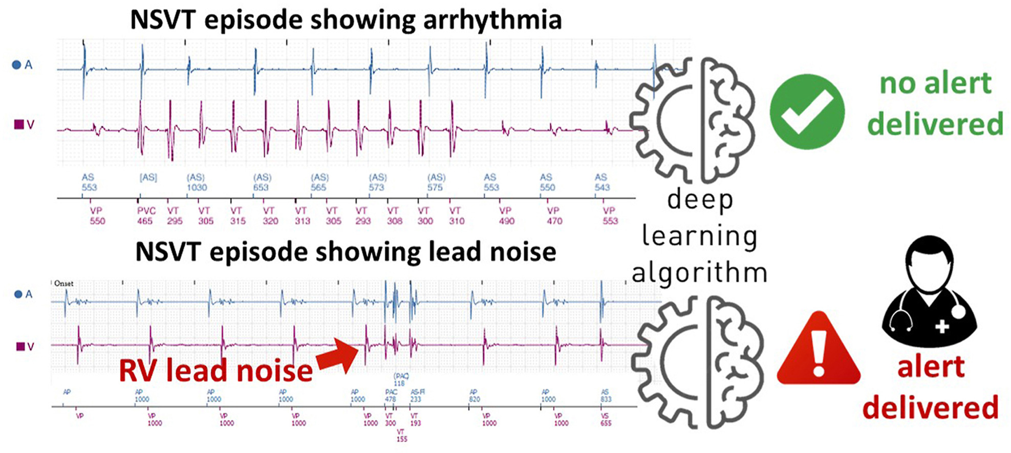 Strik Heart Rhythm 2023